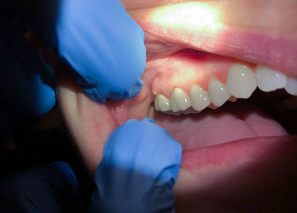 Best Emergency Denture Repair in Whitmore Lake, MI